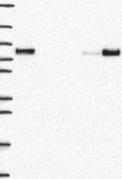 MTHFR Antibody, Novus Biologicals:Antibodies:Primary Antibodies