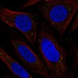 Chordin-like 2/CHRDL2 Antibody, Novus Biologicals 25 &mu;g; Unconjugated:Antibodies,
