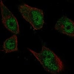 Nuf2 Antibody, Novus Biologicals 25 &mu;g; Unconjugated:Antibodies, Polyclonal