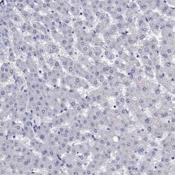 SH2D7 Antibody, Novus Biologicals 25 &mu;g; Unconjugated:Antibodies, Polyclonal