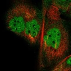 RANBP9 Antibody, Novus Biologicals 25 &mu;g; Unconjugated:Antibodies, Polyclonal