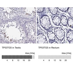 TP53TG5 Antibody, Novus Biologicals 25 &mu;g | Buy Online | Novus Biologicals | Fisher Scientific