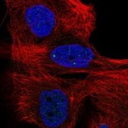 MERIT40/HSPC142 Antibody, Novus Biologicals 25 &mu;g; Unconjugated:Antibodies,