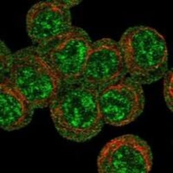 Erythropoietin R Antibody, Novus Biologicals 100 &mu;g; Unconjugated:Antibodies,