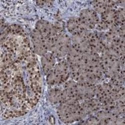 Fibrillarin Antibody, Novus Biologicals 25 &mu;g; Unconjugated:Antibodies,