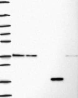 Fibrillarin Antibody, Novus Biologicals 25 &mu;g; Unconjugated:Antibodies,