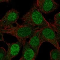 SF-1/NR5A1/Steroidogenic Factor 1 Antibody, Novus Biologicals:Antibodies:Primary