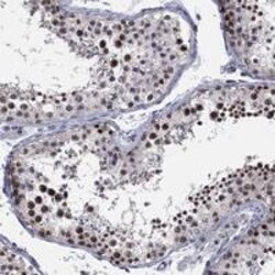 DGCR8 Antibody, Novus Biologicals 100 &mu;g; Unconjugated:Antibodies, Polyclonal