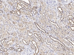PSCA Antibody, Novus Biologicals 25 &mu;g; Unconjugated:Antibodies, Polyclonal