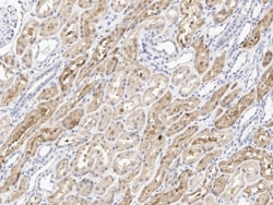 ACY3 Antibody, Novus Biologicals 25 &mu;g; Unconjugated:Antibodies, Polyclonal