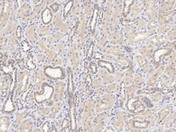 C12orf4 Antibody, Novus Biologicals:Antibodies:Primary Antibodies