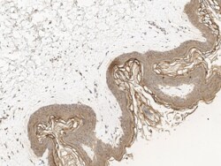 Cytokeratin 2 Antibody, Novus Biologicals:Antibodies:Primary Antibodies