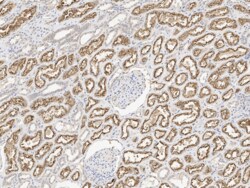 LRP2 Antibody, Novus Biologicals 25 &mu;g; Unconjugated:Antibodies, Polyclonal