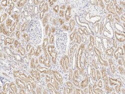 LRP2 Antibody, Novus Biologicals 25 &mu;g | Buy Online | Novus Biologicals | Fisher Scientific