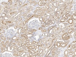 SNX2 Antibody, Novus Biologicals 100 &mu;g; Unconjugated:Antibodies, Polyclonal