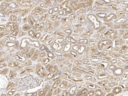 SNX2 Antibody, Novus Biologicals 25 &mu;g; Unconjugated:Antibodies