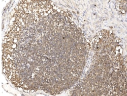 SNX2 Antibody, Novus Biologicals 25 &mu;g; Unconjugated:Antibodies