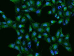 CoCoA Antibody, Novus Biologicals 100 &mu;g; Unconjugated:Antibodies, Polyclonal