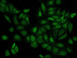 Iroquois-class homeodomain protein IRX-5 Antibody, Novus Biologicals 100