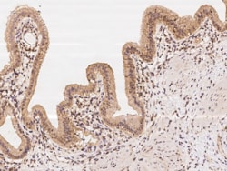 TBC1D1 Antibody, Novus Biologicals:Antibodies:Primary Antibodies