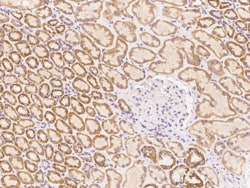 TIMM10 Antibody, Novus Biologicals:Antibodies:Primary Antibodies
