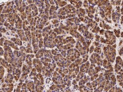 FBX09 Antibody, Novus Biologicals 25 &mu;g; Unconjugated:Antibodies, Polyclonal