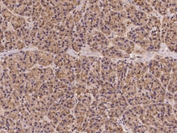 RPS4X Antibody, Novus Biologicals 25 &mu;g; Unconjugated:Antibodies, Polyclonal