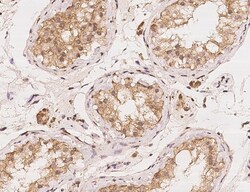 LIAT1 Antibody, Novus Biologicals 100 &mu;g; Unconjugated:Antibodies, Polyclonal