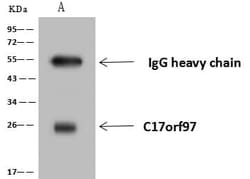 LIAT1 Antibody, Novus Biologicals 100 &mu;g; Unconjugated:Antibodies, Polyclonal