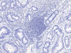 FoxP3 Antibody (03), Novus Biologicals 100 &mu;g; Unconjugated:Antibodies,