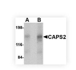 CADPS2 Antibody - BSA Free, Novus Biologicals 0.025 mg | Buy Online | Novus Biologicals | Fisher Scientific