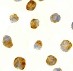 TEM8/ANTXR1 Antibody - BSA Free, Novus Biologicals 0.1 mg; Unconjugated:Antibodies,