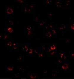 TEM8/ANTXR1 Antibody - BSA Free, Novus Biologicals 0.1 mg; Unconjugated:Antibodies,