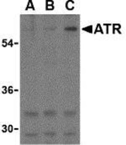 TEM8/ANTXR1 Antibody - BSA Free, Novus Biologicals 0.1 mg; Unconjugated:Antibodies,