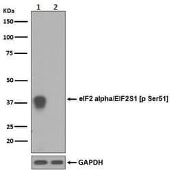 eIF2 alpha/EIF2S1, p Ser51 Antibody (SR1604), Novus Biologicals 100 &mu;g;