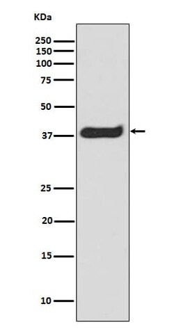 LAT, p Tyr220 Antibody (SR1644), Novus Biologicals 100 &mu;g; Unconjugated:Antikörper