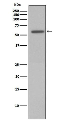 Vimentin, p Ser72 Antibody (SR1947), Novus Biologicals:Antibodies:Primary