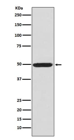 PKA R2, p Ser99 Antibody (SR1905), Novus Biologicals 50 &mu;g; Unconjugated:Antibodies,