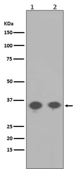 PP2A alpha, p Tyr307 Antibody (SR1588), Novus Biologicals 100 &mu;g; Unconjugated:Antibodies,