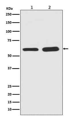 Smad5, p Ser463 Antibody (SR2030), Novus Biologicals 100 &mu;g; Unconjugated:Antibodies,