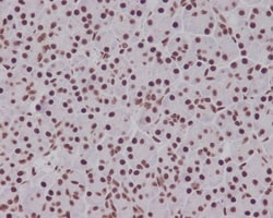 Smad5, p Ser463 Antibody (SR2030), Novus Biologicals 100 &mu;g; Unconjugated:Antibodies,