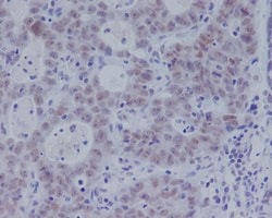 Smad3, p Ser423 Antibody (SR1995), Novus Biologicals 100 &mu;g | Buy Online | Novus Biologicals | Fisher Scientific