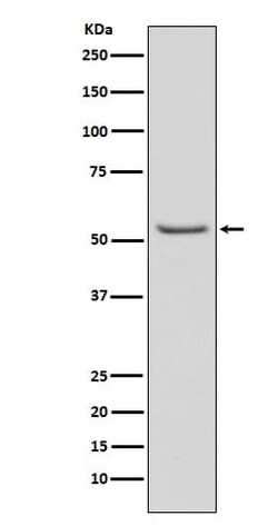 Smad3, p Ser423 Antibody (SR1995), Novus Biologicals 100 &mu;g | Buy Online | Novus Biologicals | Fisher Scientific