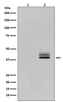 ERK1/ERK2, p Tyr204 Antibody (SR1718), Novus Biologicals 100 &mu;g; Unconjugated:Antibodies,