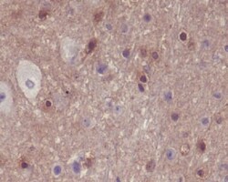 PAK1/2/3, p Ser144 Antibody (SR2102), Novus Biologicals:Antibodies:Primary
