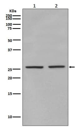 eIF4E, p Ser209 Antibody (SR1401), Novus Biologicals 50 &mu;g; Unconjugated:Antibodies,