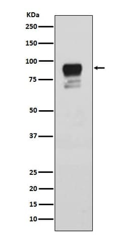 Glycogen Synthase, p Ser641 Antibody (SR2258), Novus Biologicals 50 &mu;g;