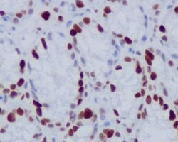 Histone H1.4, p Thr17 Antibody (SR1513), Novus Biologicals 50 &mu;g; Unconjugated:Antibodies,