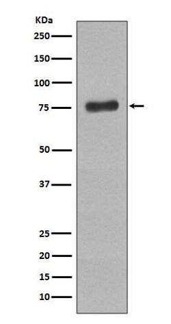 BTK, p Tyr223 Antibody (SR2206), Novus Biologicals:Antibodies:Primary Antibodies