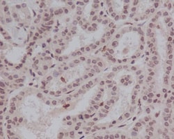 STAT5a/b, p Tyr694 Antibody (SR2280), Novus Biologicals 100 &mu;g; Unconjugated:Antibodies,